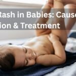 Diaper Rash In Babies: Causes, Prevention & Treatment