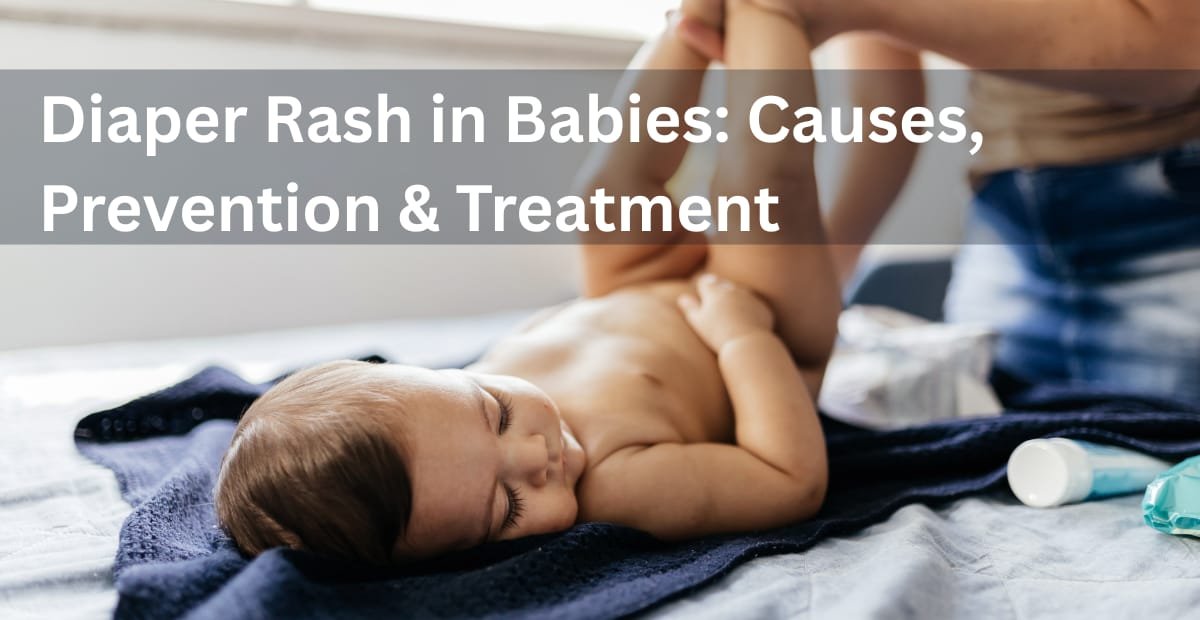 Diaper Rash In Babies: Causes, Prevention & Treatment
